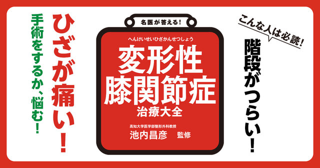 膝を診る目 診断・治療のエッセンス 名医の目のつけどころ 膝を診る目 | 木村 雅史 |本 | 通販 | Amazon